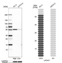 LPCAT1 Antibody, Novus Biologicals 25 &mu;L; Unlabeled:Antibodies, Polyclonal